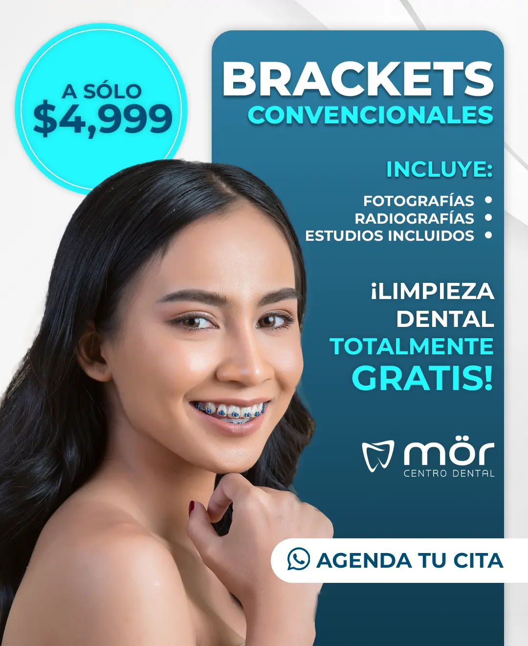 Promoción blanquamiento dental