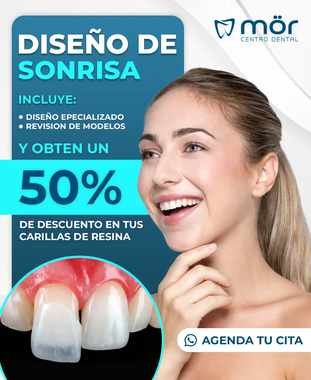 Promoción blanquamiento dental