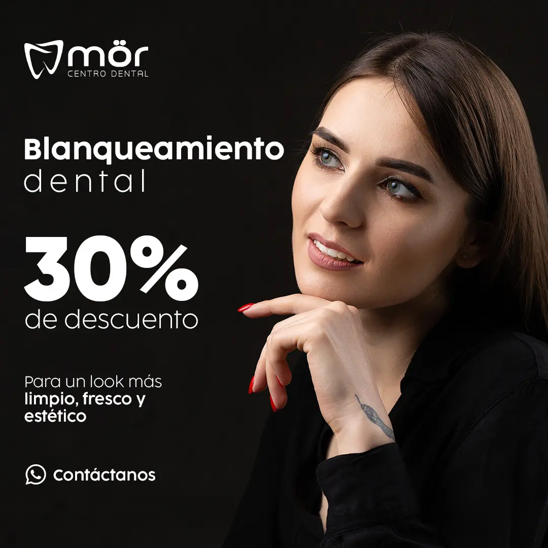 Promoción blanqueamiento dental